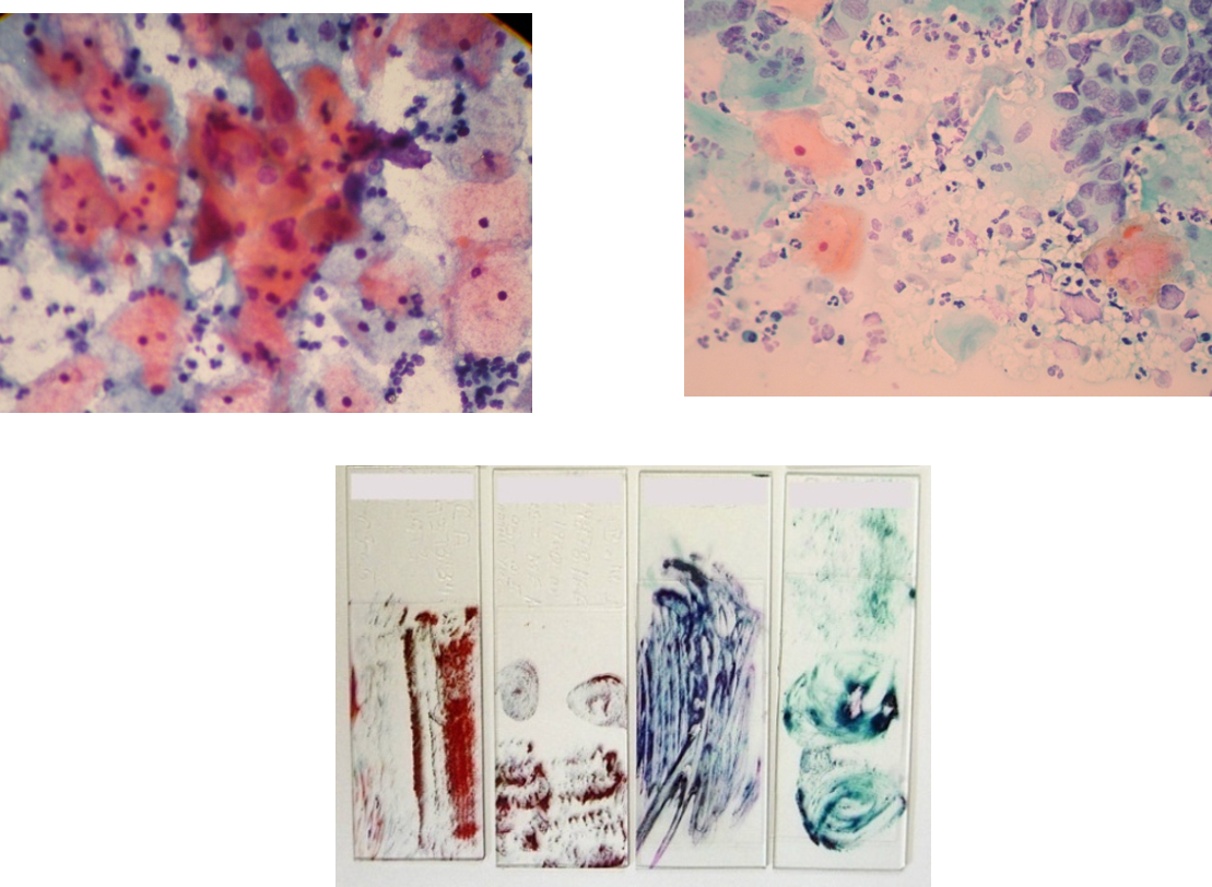 imagenes microscopicas de citologia convencional